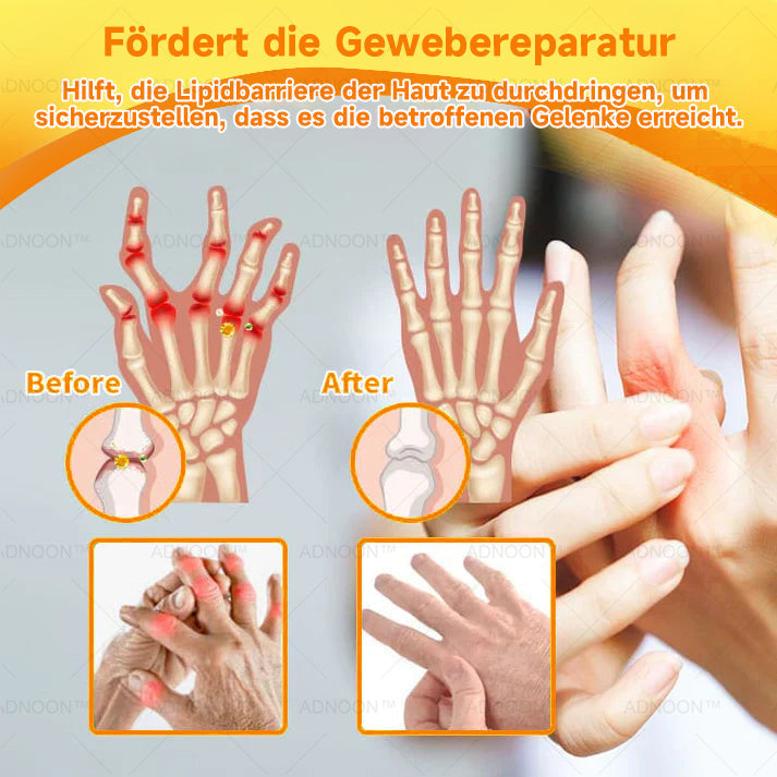 ADNOONâ˘đ¸Botulinum Toxin & Bienenvenom Schmerzlindernde Knochenheilcreme