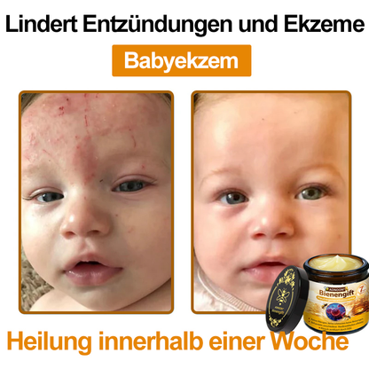 ADNOON®✈️✈️Bienengift All-in-One Pflegecreme—👨🏻‍⚕️(Empfohlen von der DDG )