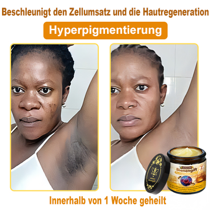 ADNOON®✈️✈️Bienengift All-in-One Pflegecreme—👨🏻‍⚕️(Empfohlen von der DDG )
