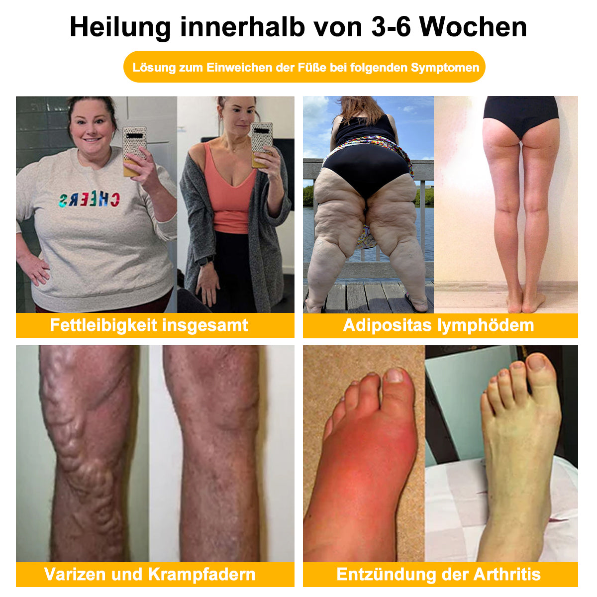 VascuTone™ 🍃 Bienengift Schlankheits-Detox-Fußbad-Perlen - (EU Lymphatic Association ELA zertifiziert)