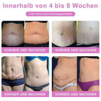 KaaLa™🔥🔥Negative Ion Fettverbrennende, Bauchstraffende, Entgiftende Formhosen【Letzte 20 Minuten, begrenztes Angebot: 60% Rabatt】