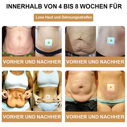 🐝✨ AFGAFG™🌿🌿 Bienen-Venom Lymphatischer Drainage Schlank-Patch【Empfohlen vom Arzt - Geeignet für Männer und Frauen】