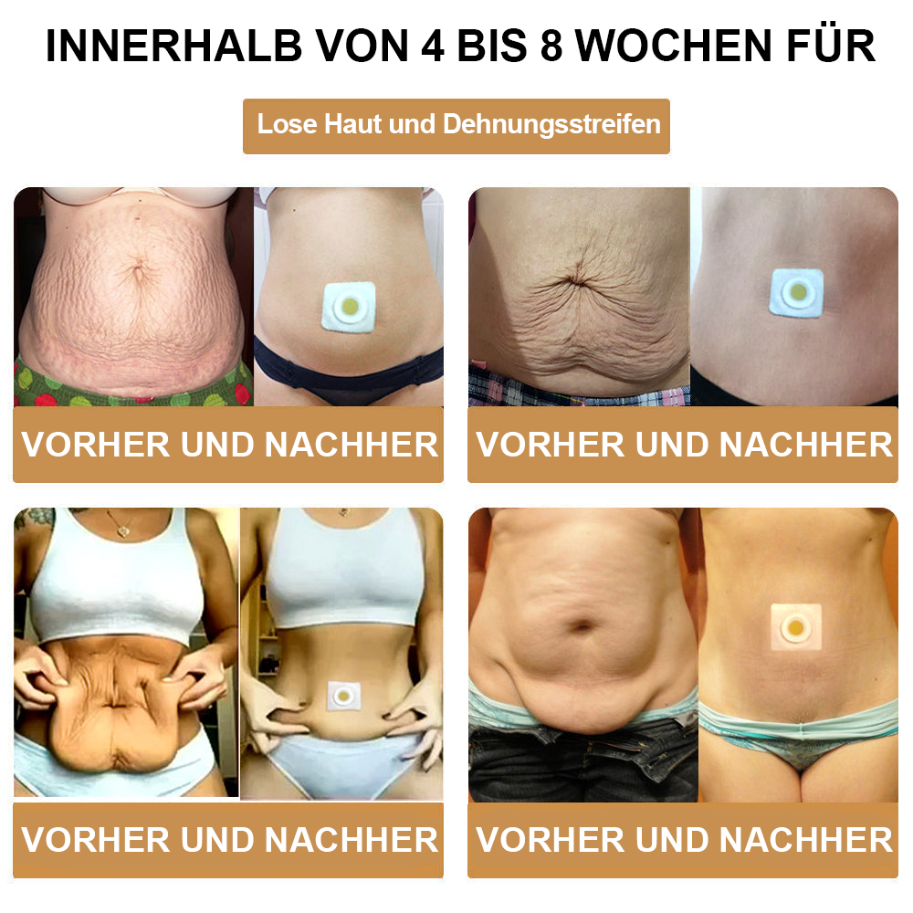 AFGAFG™🐝🐝 Bienen-Venom Lymphatischer Drainage Schlank-Patch【Empfohlen vom Arzt - Geeignet für Männer und Frauen】