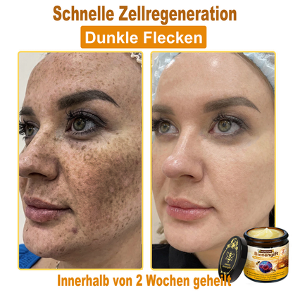ADNOON®✈️✈️Bienengift All-in-One Pflegecreme—👨🏻‍⚕️(Empfohlen von der DDG )