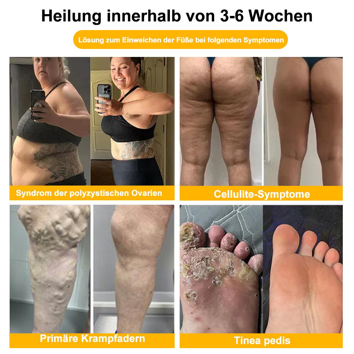 VascuTone™ 🍃 Bienengift Schlankheits-Detox-Fußbad-Perlen - (EU Lymphatic Association ELA zertifiziert)