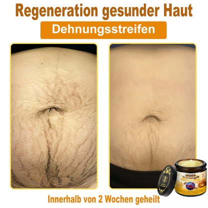 ADNOON®✈️✈️Bienengift All-in-One Pflegecreme—👨🏻‍⚕️(Empfohlen von der DDG )