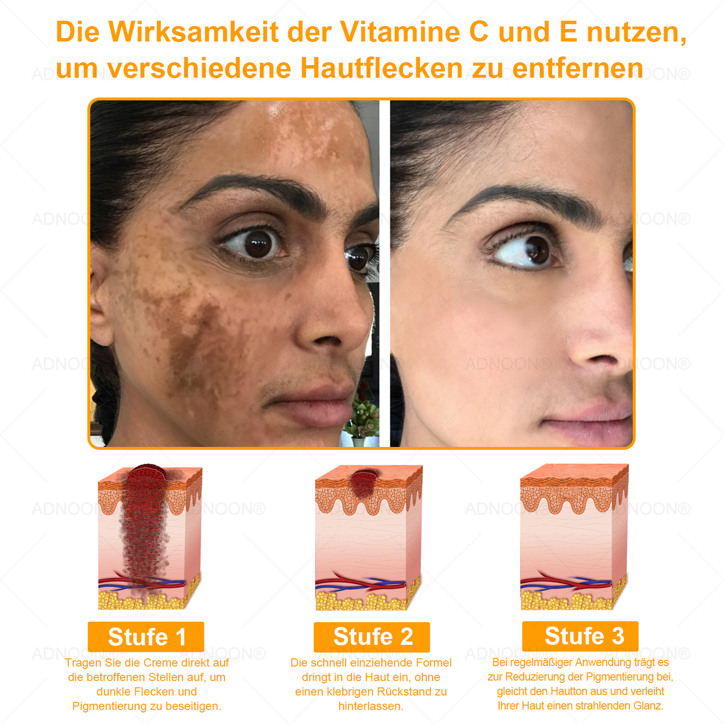 Letzte Chance! 🌸 Sichern Sie sich dieses Glücksangebot mit 70% Rabatt! 🔥 180 Tage Rückerstattungsgarantie! Kostenloser Luftversand!