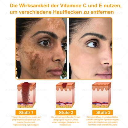 Nur 5 Gläser verfügbar! 🌸 Jetzt zugreifen und exklusiven 50% Rabatt erhalten! In nur einer Woche Ihre Haut zum Strahlen bringen. Verpassen Sie nicht diese Gelegenheit – dieses Angebot wird erst nächstes Jahr wieder verfügbar sein. Handeln Sie schnell!