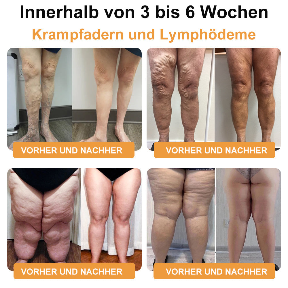 RevivaFoot™🌿🌿Bienenvenom Lymphdrainage- und Schlankheits-Fußbadperlen 70 % RABATT【Arztempfehlung - Bei allen lymphatischen Problemen und Fettleibigkeit】