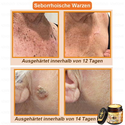 ADNOON®🌻Bienengift All-in-One Pflegecreme—Empfohlen von der DDG 🏅