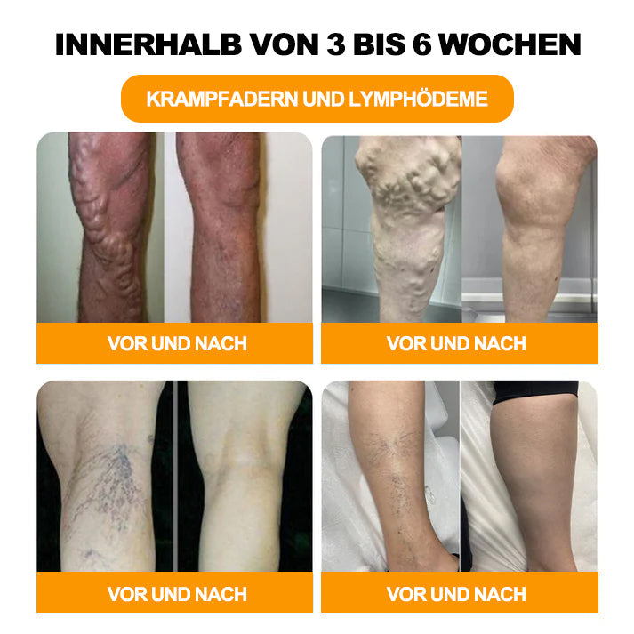 RevivaFoot™🌿🌿Bienenvenom Lymphdrainage- und Schlankheits-Fußbadperlen 70 % RABATT【Arztempfehlung - Bei allen lymphatischen Problemen und Fettleibigkeit】