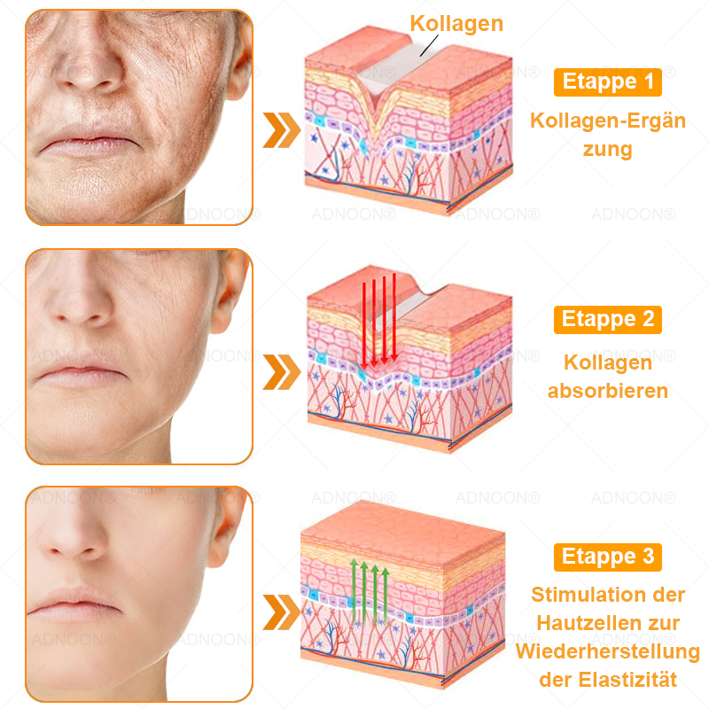 Letzte Chance! 🌸 Sichern Sie sich dieses Glücksangebot mit 70% Rabatt! 🔥 180 Tage Rückerstattungsgarantie! Kostenloser Luftversand!