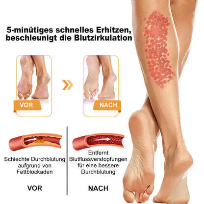 RevivaFoot™🌿🌿Bienenvenom Lymphdrainage- und Schlankheits-Fußbadperlen 70 % RABATT【Arztempfehlung - Bei allen lymphatischen Problemen und Fettleibigkeit】