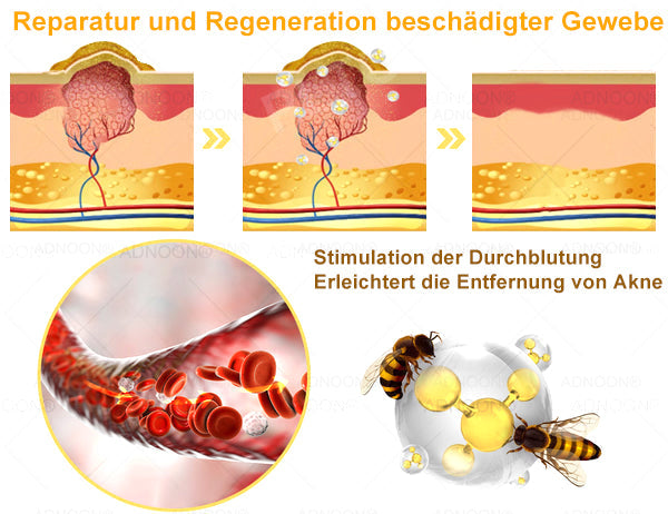 ADNOON® 🌸-Day Schnell Hautreparaturcreme – Angetrieben von AAD👨‍⚕️