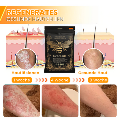 VascuTone™ 🍃 Bienengift Schlankheits-Detox-Fußbad-Perlen - (EU Lymphatic Association ELA zertifiziert)