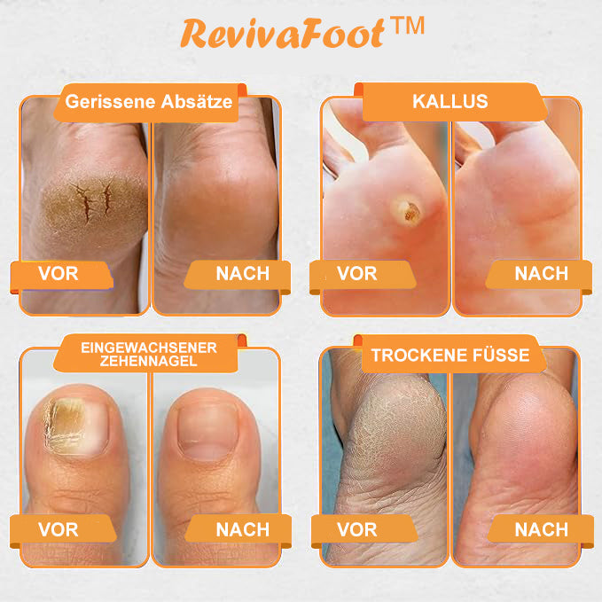 RevivaFoot™🌿🌿Bienenvenom Lymphdrainage- und Schlankheits-Fußbadperlen 70 % RABATT【Arztempfehlung - Bei allen lymphatischen Problemen und Fettleibigkeit】